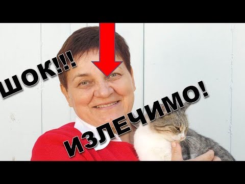 Видео: Мои секреты удаления папилломы. Как в домашних условиях вывести папилломы? Чем удалить папиллому?