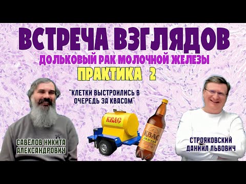 Видео: ДОЛЬКОВЫЙ РАК МОЛОЧНОЙ ЖЕЛЕЗЫ || Практика №2 || ВСТРЕЧА ВЗГЛЯДОВ || Савёлов Н.А, Строяковский Д.Л.