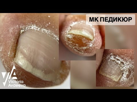 Видео: ПЕДИКЮР  Виктория Авдеева