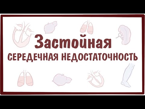 Видео: Застойная сердечная недостаточность