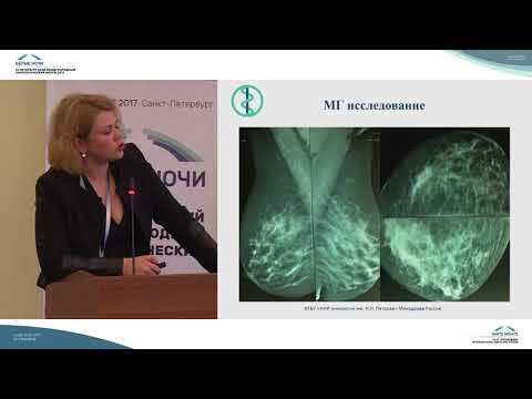Видео: Мультимодальный подход к первичной диагностике опухолей молочной железы