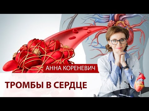 Видео: Тромбы в сердце. Что это такое?