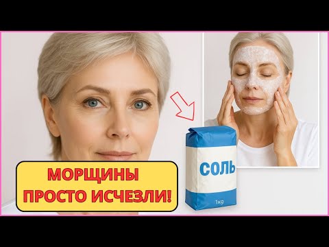 Видео: Просто СОЛЬ и ЛИЦО как в 30 ЛЕТ! Маска от МОРЩИН и дряблости кожи. Сразу 4 рецепта!
