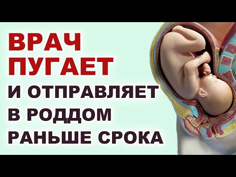 Видео: Как в дородовом отделении стимулируют быстрые роды? Ехать в роддом до срока? Манипуляции в роддоме.
