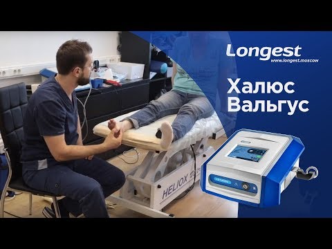 Видео: Ударно-Волновая Терапия при Hallux valgus