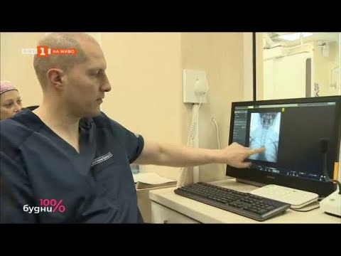 Видео: Зад вратите на Референтния център по мозъчно-съдови заболявания в УМБАЛ "Св. Иван Рилски" - 22.06.23