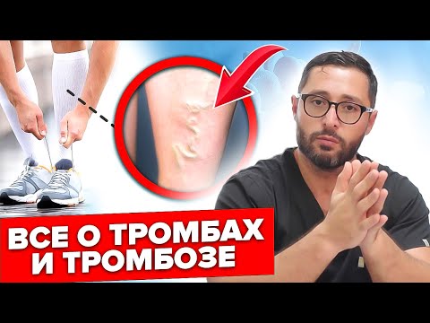 Видео: Реальные причины и последствия тромбоза. Как избежать и лечить?