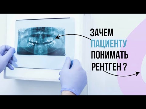 Видео: Как пациенту научиться “читать” рентген❓