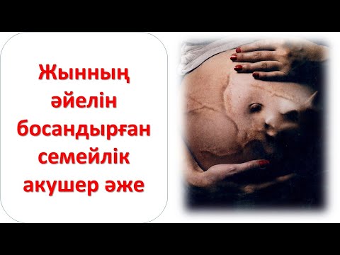 Видео: Жынның әйелін босандырған семейлік акушер әже