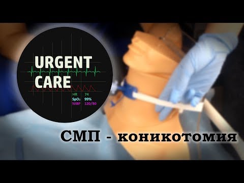Видео: СМП - Коникотомия