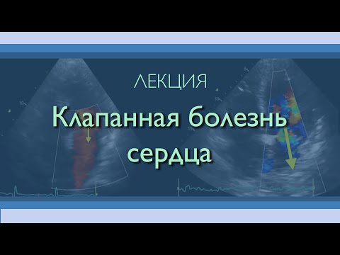 Видео: Клапанная болезнь сердца