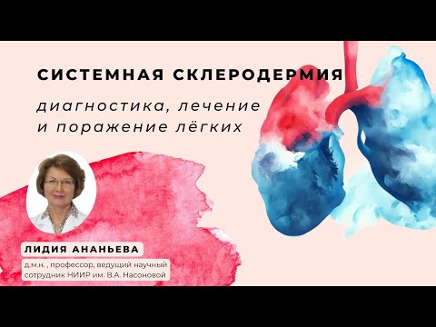 Видео: Системная склеродермия: что должен знать пациент