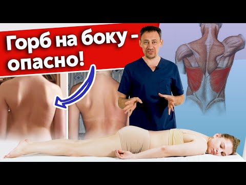 Видео: Асимметрия широчайшей мышцы спины / Мануальная терапия и тренировка для красивой осанки