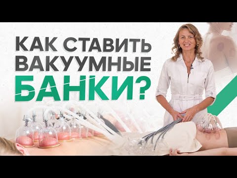 Видео: Как правильно ставить вакуумные аппаратные банки?