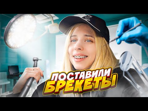 Видео: Мне поставили БРЕКЕТЫ // ЖИЗА С КОШ