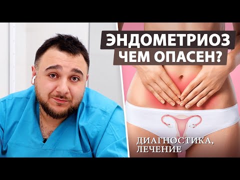 Видео: Эндометриоз: Что нужно знать каждой женщине?