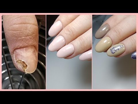 Видео: ОНИХОЛИЗИС на ВСЕХ ногтях!ЖЕСТЬ/2 маникюра/маникюр на клиенте