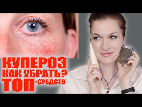 Видео: Полная система ухода против купероза! От очищения до ночной рутины. 100% результат! 💥💥💥