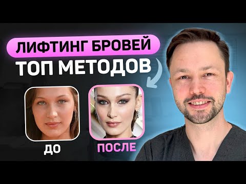 Видео: Топ способов подтянуть брови. Мнение косметолога и пластического хирурга.