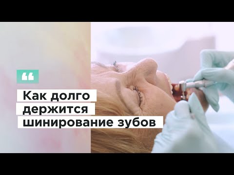Видео: Как долго держится шинирование зубов