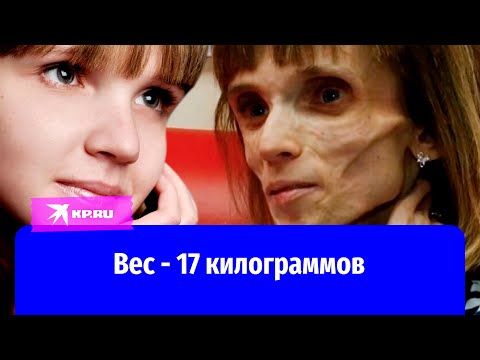 Видео: Девушка весом 17кг