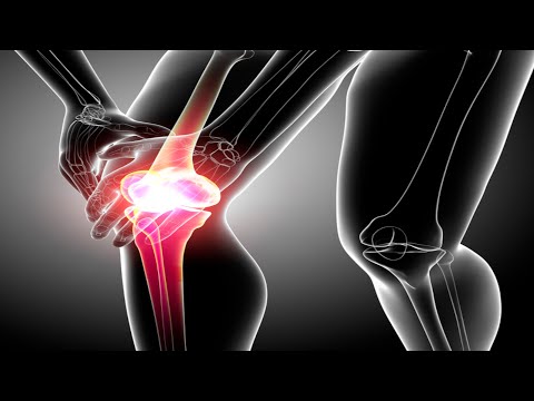 Видео: Тендинит надколенника (Колено прыгуна)