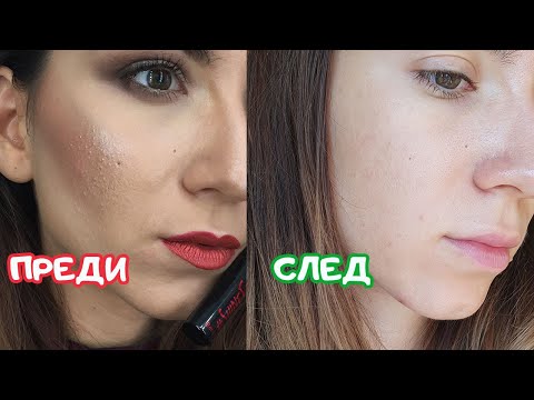 Видео: КАК СЕ СПРАВИХ С АКНЕТО И РЕЛЕФА !
