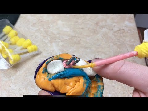Видео: Силиконовая десна Gingifast Rigid . Зубной техник. А-силикон .