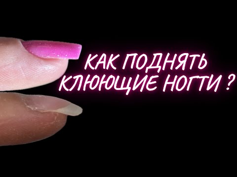 Видео: КАК ПОДНЯТЬ КЛЮЮЩИЕ НОГТИ? Коррекция гелем тонко!