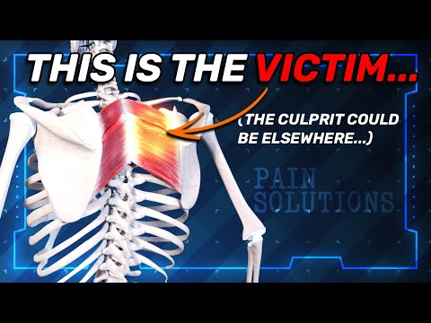 Видео: Что НА САМОМ ДЕЛЕ означает эта обычная боль (...Это не то, что вы думаете?)