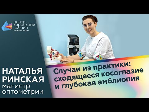 Видео: Случаи из практики: сходящееся косоглазие и глубокая амблиопия