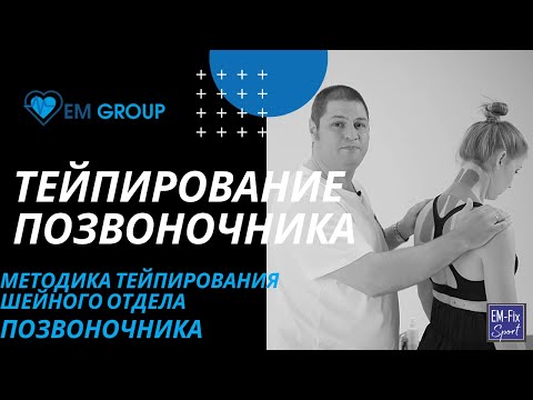 Видео: Тейпирование шейного отдела позвоничника