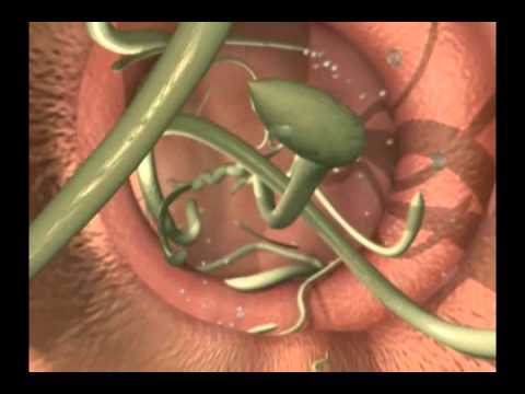 Видео: Токсокароз у собак и кошек