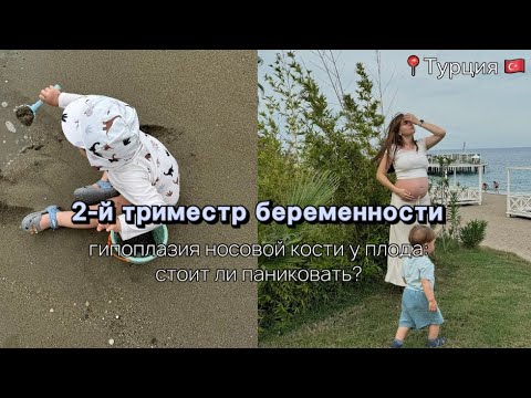 Видео: 2-й триместр беременности. Гипоплазия носовой кости. Как проходили первые роды. Наш отпуск в Турции