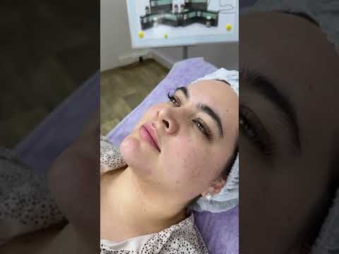 Видео: Липолитики AGT-M (Испания)