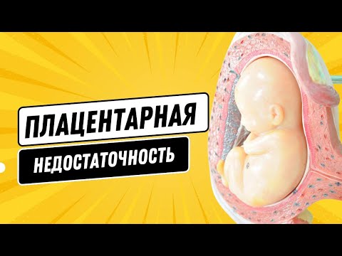 Видео: ПЛАЦЕНТАРНАЯ НЕДОСТАТОЧНОСТЬ  @DrOlenaB #плацента #плацентарнаянедостаточность #беременность