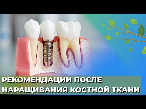 Видео: Рекомендации после наращивания костной ткани