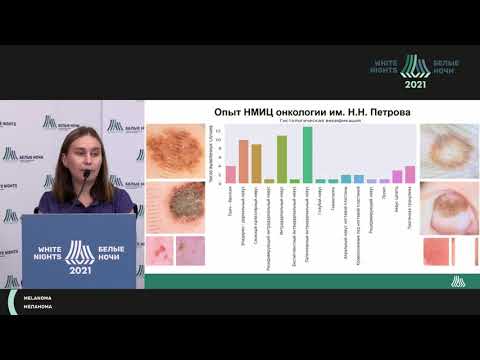 Видео: Меланома у детей и подростков (Хабарова Р.И.)