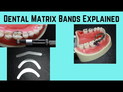 Видео: Что такое зубная матричная лента?