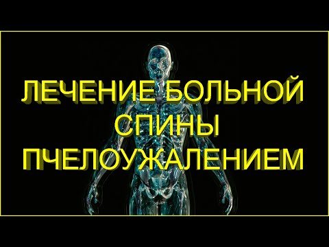 Видео: 🐝 Пчелоужаления при больной спине 🐝