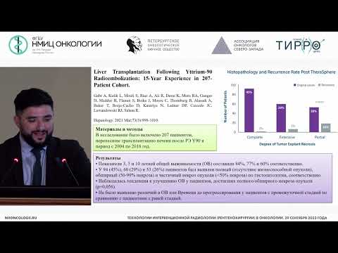 Видео: Радиоэмболизация в лечении гепатоцеллюлярного рака