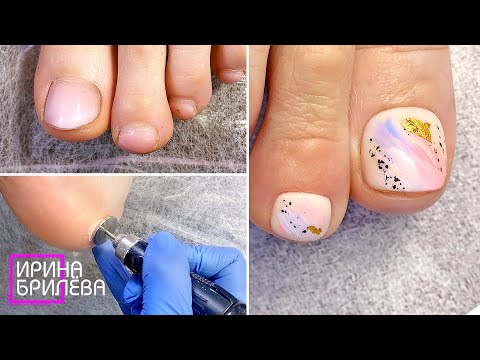 Видео: ПЕДИКЮР по сухой, огрубевшей коже 🌸 Ремонт ногтя с помощью полигеля 🌸 Ирина Брилёва