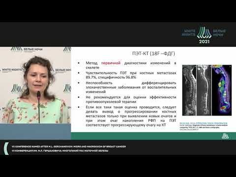 Видео: Когда метастазы в кости единственное проявление болезни: диагностика, клиника, лечение