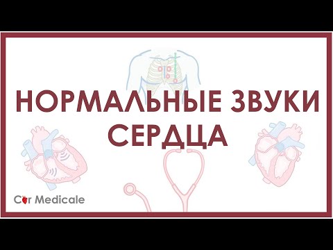 Видео: Нормальные звуки сердца, точки аускультации, тоны сердца S1 и S2