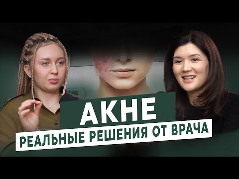 Видео: ВСЯ ПРАВДА ОБ АКНЕ: РАЗВЕНЧИВАЕМ МИФЫ И РАСКРЫВАЕМ СЕКРЕТЫ ЛЕЧЕНИЯ