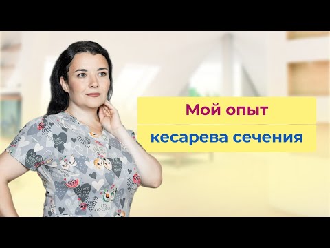 Видео: Кесарево сечение. Мой опыт двух родов Врач-педиатр.