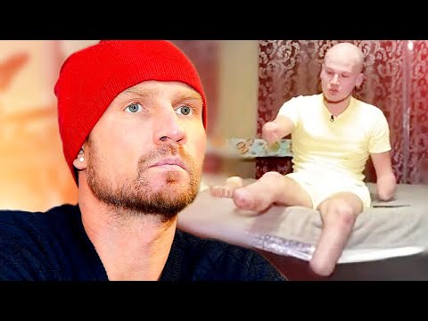 Видео: Роман Костомаров сегодня | Без рук и ног блогер Игорь Кошкин дал совет Костомарову Как жить дальше?