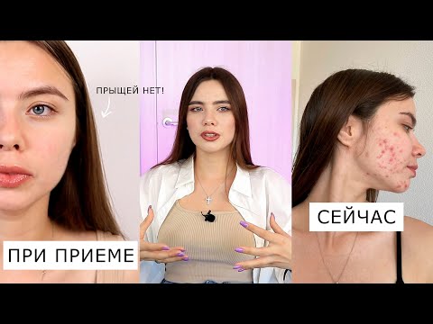 Видео: МНЕ НЕ ПОМОГ РОАККУТАН 😭