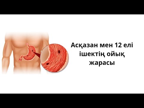 Видео: Ойық жара ауруы. Асқазан мен он екі елі ішектің ойық жарасы.