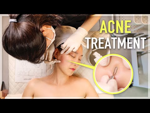 Видео: ASMR / Самое приятное выдавливание прыщей и массаж лица